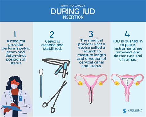 iud insertion mirena steps