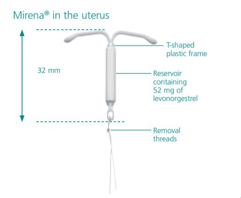 iud mirena length