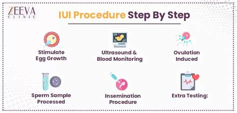 iui procedure step by step pdf