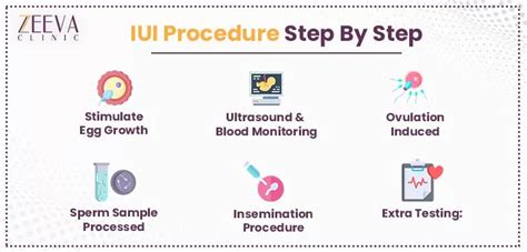 iui step by step