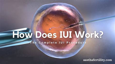 iui treatment video