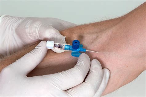 Iv Injection Into Artery
