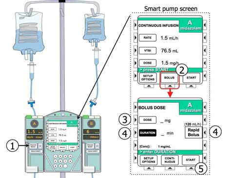 Iv Pump Bolus