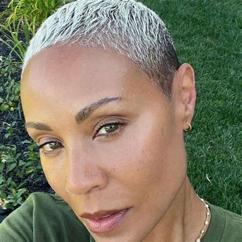 jada pinkett smith really have alopecia