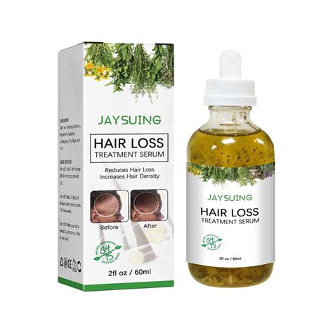 jaysuing hair growth serum reviews