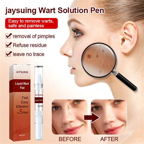 jaysuing wart solution pen