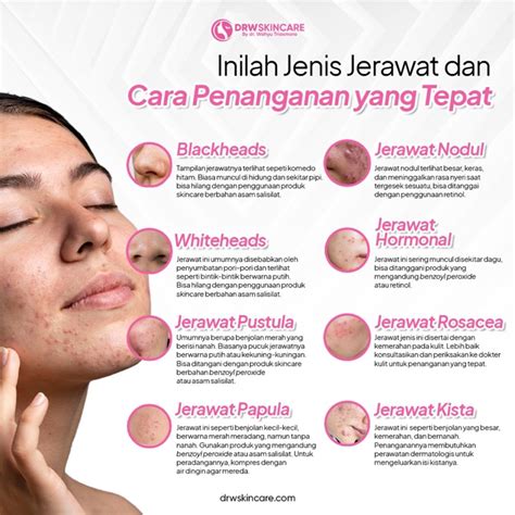 jenis jerawat
