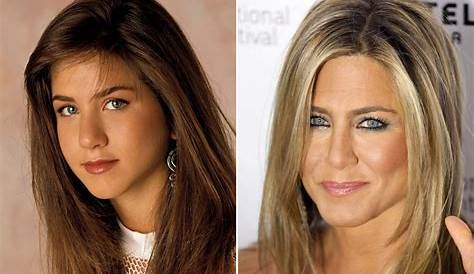 Jennifer Aniston's Nose Job: Uncovering Secrets And Expert Insights