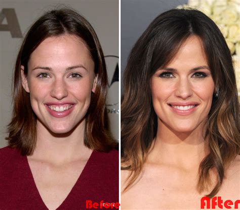 jennifer garner before and after