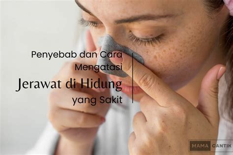 Hilangkah Jerawat Hidung Membandel dan Raih Wajah Mulus Tanpa Pusing