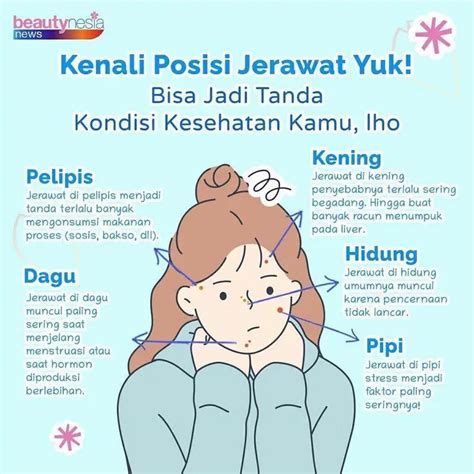 Jerawat di Jidat Bikin Pusing? Atasi dengan 7 Tips Sederhana Ini!