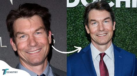 jerry o'connell botox