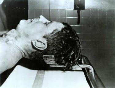 Unveiling the Truth: Exclusive JFK Autopsy Photos That Shock History