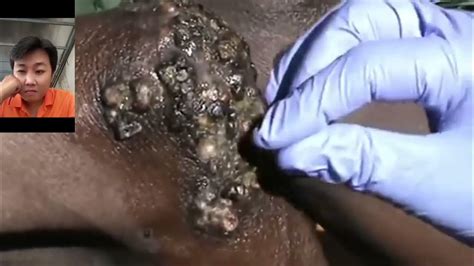 Jigger Digging Andrew