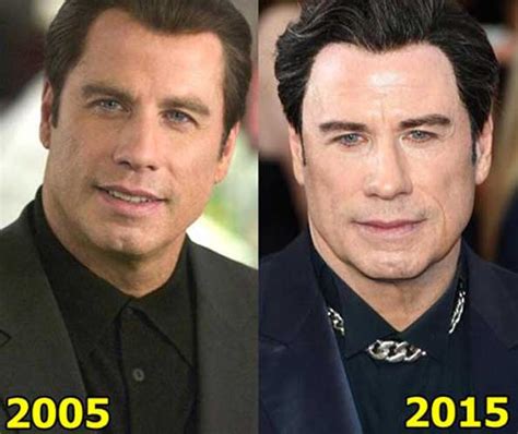 john travolta face lift