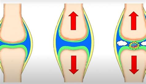 Joints Cracking Breastfeeding