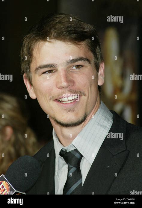 josh hartnett teeth