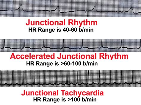 Junctional Line Definition