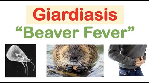 just in fever beaver