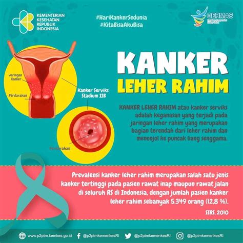 Kanker Leher Rahim Di Indonesia: Pengertian, Penyebab, Gejala, Dan Pencegahan