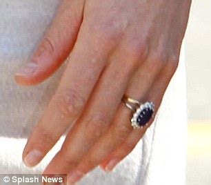 kate middleton missing wedding ring