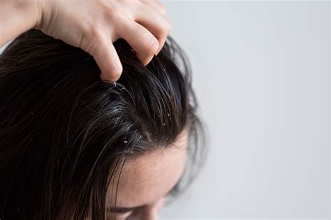 Rambut Rontok Berlebihan: Penyebab dan Cara Mengatasinya