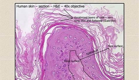 Keratinized Stratified Squamous Epithelium Labeled Thick Skin