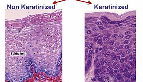 Keratinized Vs Non Keratinized Stratified Squamous Epithelium Definition, Types & Examples