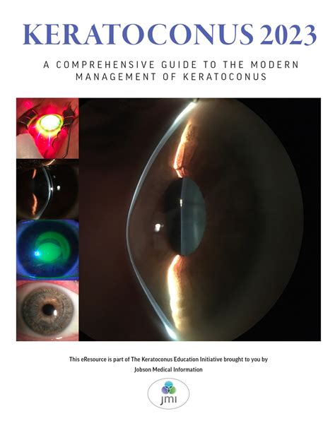 keratoconus review of optometry