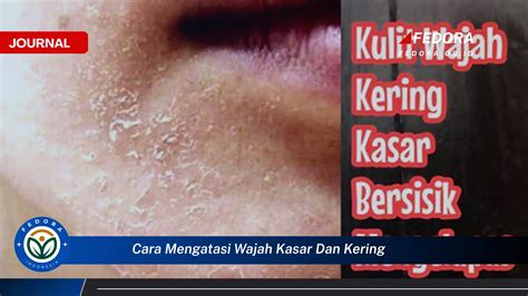 kering dan kasar