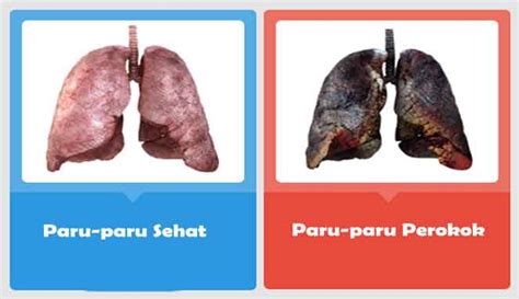 kesan merokok terhadap peparu