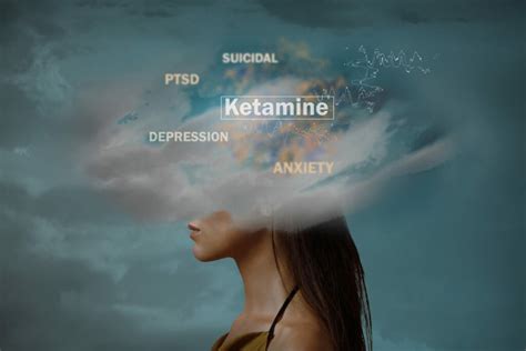 ketamine iv therapy cost