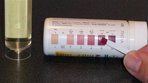 Ketone Test Strips Levels