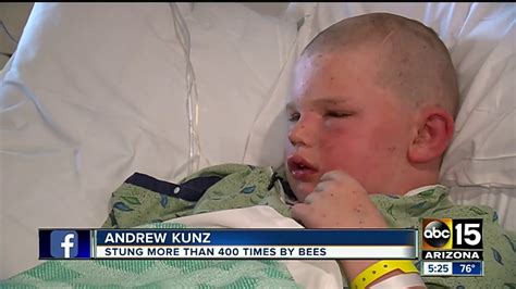 kid gets stung by a bee