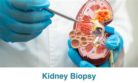 Kidney Biopsy Guidelines