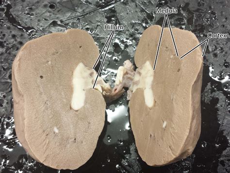 kidney in fetal pig