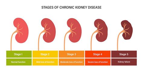 Understanding Kidney Problem Stages: A Guide to Early Detection and Prevention