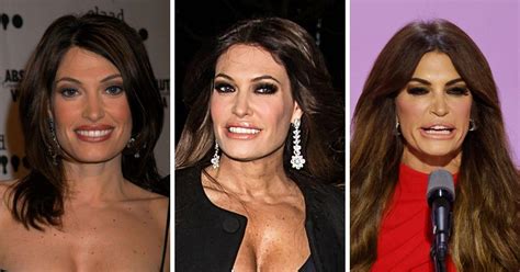 kimberly guilfoyle plastic surgery