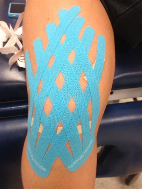 kinesiology knee taping techniques