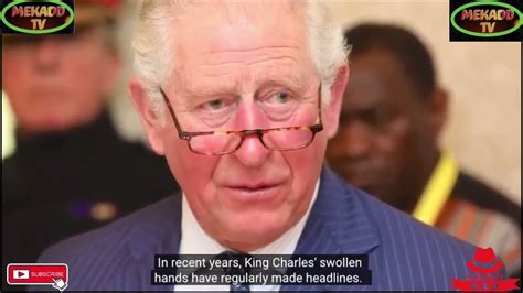 king charles health scare
