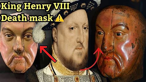 king face cause of death