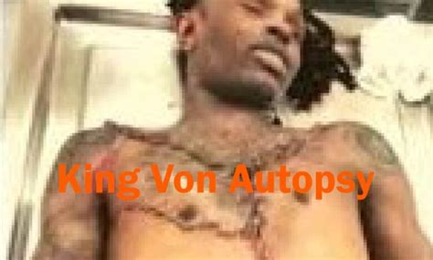 king vons autopsy