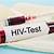 klinik hiv test