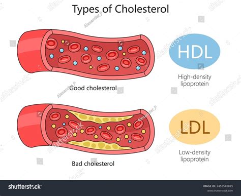 Kolesterol HDL