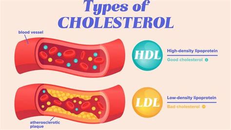 Kolesterol LDL