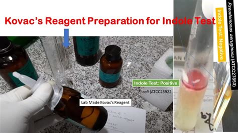 kovacs reagent preparation