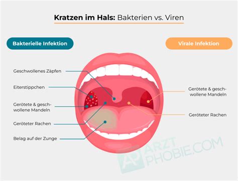 kratzen im hals geht nicht weg