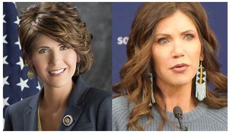 Kristi Noem’s Plastic Surgery Couldn’t Be More Obvious to Viewers in
