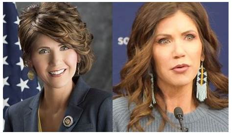 Kristi Noem Plastic Surgery: Inside Her Plastic Surgery Procedures