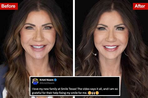 kristi noem teeth commercial